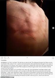 Does esme bianco have tattoos? The Claims Of Esme Bianco Who Fell Under Marilyn Manson Apos S Spell Hot Lifestyle News
