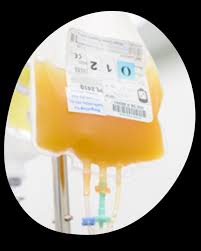 Image result for Platelet Transfusion
