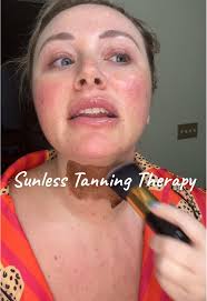 Sunless Tanning Therapy for a Positive Mood