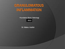 Check spelling or type a new query. Granulomatous Inflammation Ppt Video Online Download