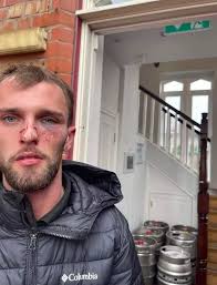 Security staff suspended after claims man was beaten unconscious by five  bouncers outside club in Gay Village