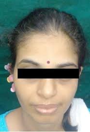 Index Copernicus ID 5385 ISSN No. 0972-396X Quarterly Publication of Indian  Dental Association, Kerala State Branch