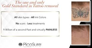 The removal process requires time and patience to ensure both safety and efficacy. Picosure Tattoo Removal Anna Avaliani Md Cosmetic Laser Surgery Anna Avaliani Md Cosmetic Laser Surgery