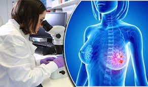 Breast Cancer Treatment Genetic Test To Tell How Long Patients Might Live For Express Co Uk