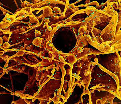 Also, it may cause a wide spectrum of skin rashes, including those similar to chilblain, livedo vasculitis, urticaria, vesicles and maculopapular rash including morbilliform rash, which represents a viral exanthema , , . Nih Begins Study Of Allergic Reactions To Moderna Pfizer Biontech Covid 19 Vaccines National Institutes Of Health Nih