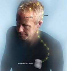 NIH MedlinePlus the Magazine Winter 2014