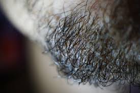Avoid digging under the skin. The Best Ways To Prevent Ingrown Hairs After Waxing Waxing 4 Men