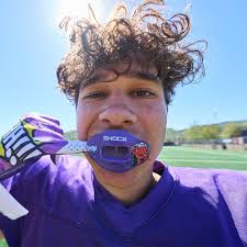 Kool Aid Mouthguard For Braces Shock Doctor Kool-Aid Lip Guard Mouthguard