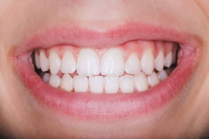  how to remove tartar from teeth
