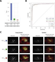 A pet scan is most often used when other tests, such as mri scan or ct scan, do not provide enough information or physicians are looking for the potential spread of the breast cancer to lymph nodes or beyond. Automated Detection Of Lung Cancer At Ultralow Dose Pet Ct By Deep Neural Networks Initial Results Lung Cancer