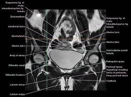 Pelvis Cross Sectional Mri Imagelarge Jpg 550 406 Diagnostic Imaging Mri Radiology Imaging
