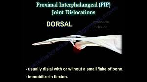 Image result for Lateral PIP Dislocation