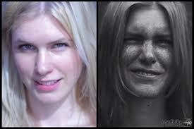 Do you have UV damage?