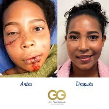 Galo Fernando Guzmán Castillo (@galofernandogc) • Foto dan video Instagram