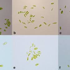 Kontakty 377 959 155 724 179 192 hromnice@hromnice.cz datová schránka:n9ka4br. Morphology Of Coccomyxa Strains Included In This Study A Plesne Lake Download Scientific Diagram