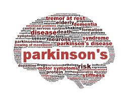 Diagnosing parkinson's disease is actually hard work, and mistakes can be made (click here for more on this). Management Of Psychosis In Parkinson Disease