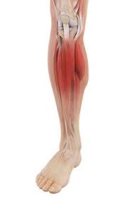 Shin Splints El Paso | Rigid Foot Arches | Flatfoot El Paso