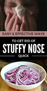 Runny nose is a very common and annoying problem which most of us experience during cold and dry season. 34 Ways To Get Rid Of A Runny Nose Ideas Runny Nose Stuffy Nose Stuffy Nose Remedy
