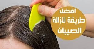 افضل طريقه لازالة الصيبان من الشعر يعتبر قمل الرأس من الأمراض الشائعة ويظهر في الغالب عند الأطفال إن القمل معدي جدا حيث أنه يمكن أن ينتقل بسهو lice removal hair