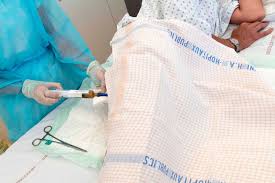 Image result for Fecal Transfer