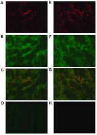 In some individuals, the stools may appear so dark that they have a tarry appearance. Two Color Immunofluorescence Staining Of Primary Colon Cancer Tissue Download Scientific Diagram