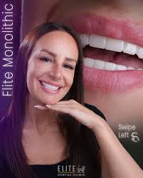 Elit Dental Clinic Kusadasi