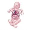A congenital pulmonary airway malformation (cpam), also known as congenital cystic adenomatoid malformation (ccam), is a cystic piece of abnormal lung tissue that. 1