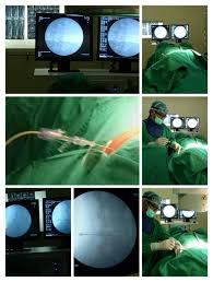 Hasil gambar untuk Dokter Syaraf Terjepit Surabaya