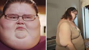 Nainen painoi yli 300 kiloa