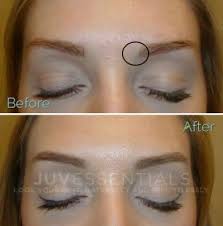 However, it's not a quick fix process and it's not for everybody. How To Fix Tattooed Eyebrows Eyebrowshaper