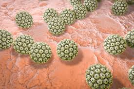 There are over 100 types of hpv. Feigwarzen Symptome Und Behandlung Heilpraxis