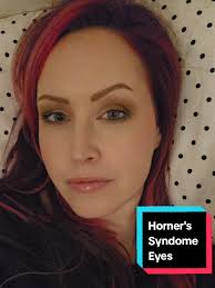 Stacey Diagnosed Yolanda