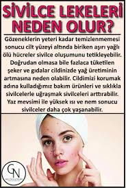 Sivilce Lekeleri Neden Olur Cilt Bakim Urunleri Cilt Bakimi Yag