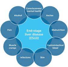Supportive Care In End Stage Liver Disease A Clinical Review Gastrointestinal Nursing