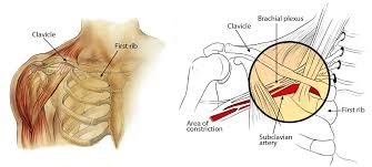 The body part that is right under the right side of the rib cage is the right hip. Thoracic Outlet Syndrome Orthoinfo Aaos