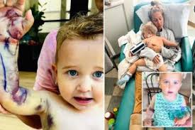 California family charged nearly $300K for life-saving cure after  rattlesnake bit 2-year-old