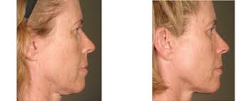 Michèle in wonderland: juin 2015