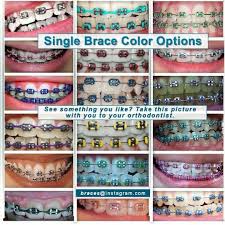 Single Color Braces Braces Colors Cute Braces Colors Cute Braces