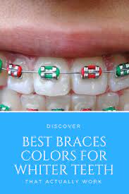 If you whiten your teeth with braces on you'll most likely end up with spots from the bleach only getting on the exposed enamel. How To Whiten Teeth With Braces Arxiusarquitectura