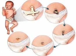 Keep the cord clean and dry at all times. A Guide On Newborn Umbilical Cord Care Mr Storkey