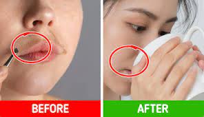 Wash the face with cold water. 9 Simple Ingredients To Get Rid Of Facial Hair At Home