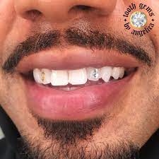 24k Gold Dollar Sign Tooth Gem Tooth Gem Teeth Aesthetic Teeth