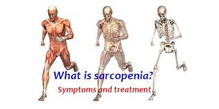 Check spelling or type a new query. What Is Muscle Loss Sarcopenia Symptoms And Treatment