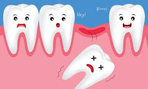 Sonar Que Se Te Caen Los Dientes Problemas De Autoestima