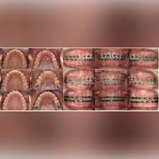 Image result for Malouetia mildbraedii