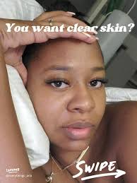 You want clear skin?
