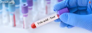 Reduce Uric Acid Naturally with Diet ...