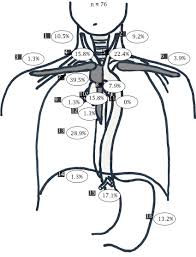 Lymphoma, thoracic or retroperitoneal cancer, bacterial or fungal infection. Pattern Of Lymph Node Metastases 1 Right Cervical 2 Left Cervical Download Scientific Diagram