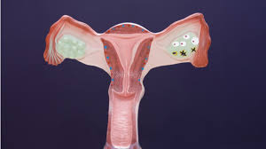 We did not find results for: Apa Bedanya Kista Bartholin Kista Nabothi Dan Kista Gartner