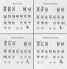 Autosome, chromosomal disorder, chromosome, genome … How Do Different Peoples Chromosomes Compare